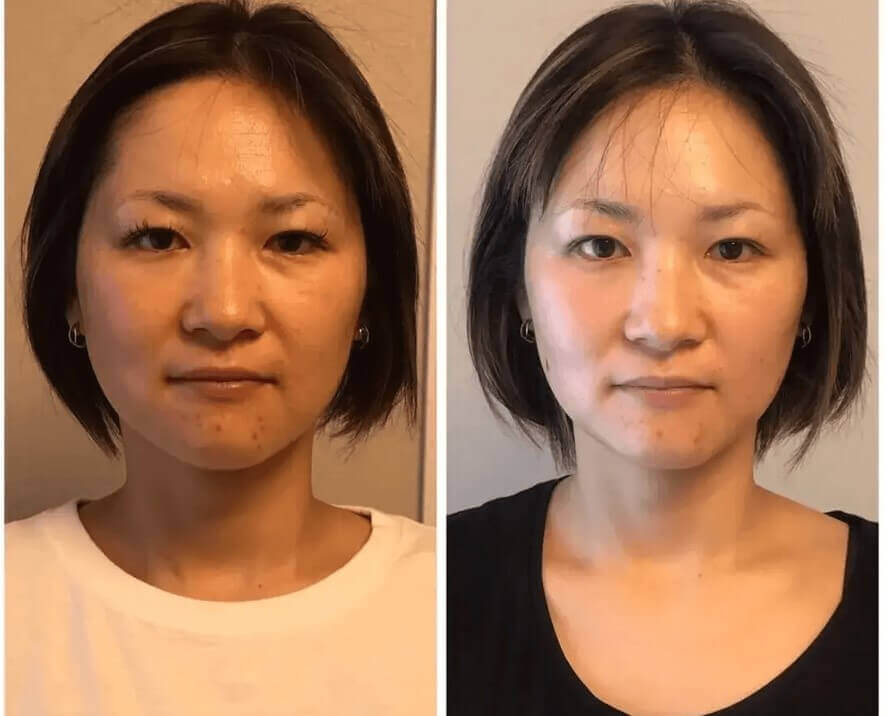 beforeAfter